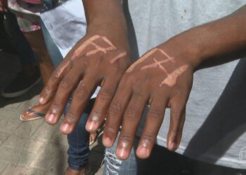 Empresário e gerente suspeitos de queimar mãos de funcionários em Salvador são indiciados por tortura