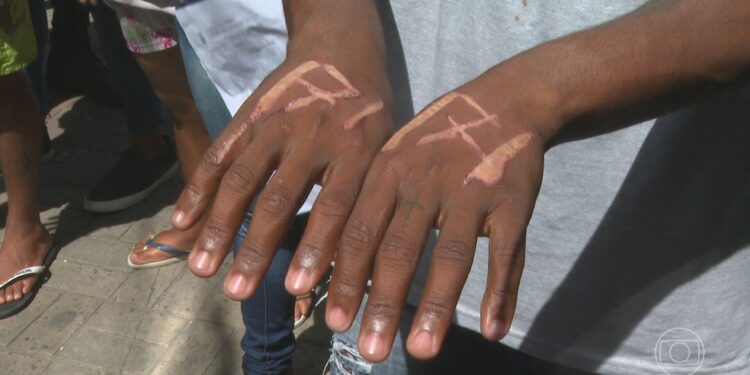 Empresário e gerente suspeitos de queimar mãos de funcionários em Salvador são indiciados por tortura