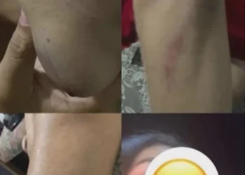 Mulheres trans são agredidas por seguranças de bar no sul da Bahia