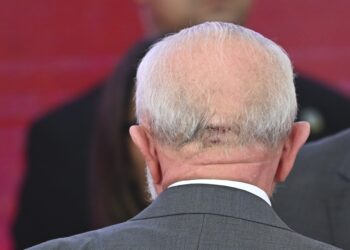 Lula é operado às pressas em São Paulo após sentir dor na cabeça