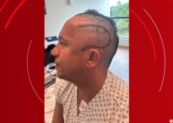 Empresário canta hino do Bahia durante cirurgia para retirada de tumor cerebral: ‘Homenagem em um momento difícil’