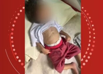 Bebê de 1 ano morre ao dar entrada em hospital na Bahia com desnutrição e marcas de agressão; pais foram presos por maus-tratos