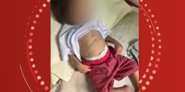 Bebê de 1 ano morre ao dar entrada em hospital na Bahia com desnutrição e marcas de agressão; pais foram presos por maus-tratos