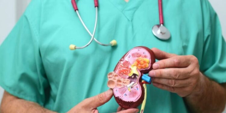 Câncer Renal: urologista alerta para a importância do diagnóstico precoce