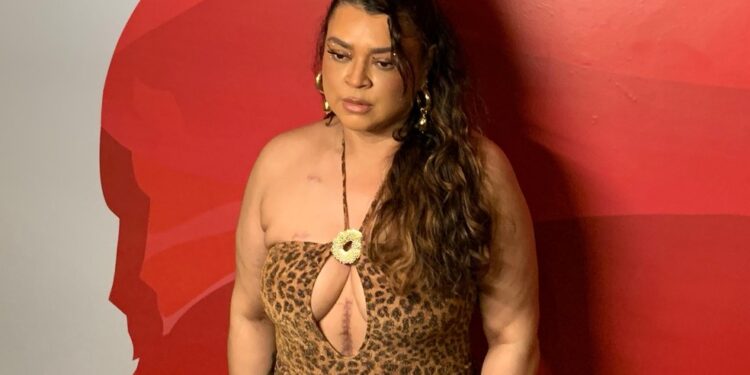 Preta Gil é internada com infecção urinária em hospital de Salvador