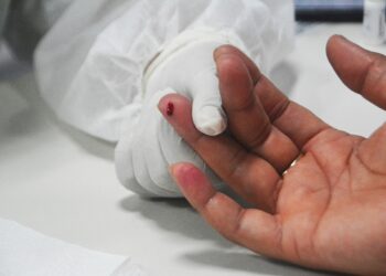 Julho Amarelo: em Feira 1.588 pacientes são acompanhados no programa municipal