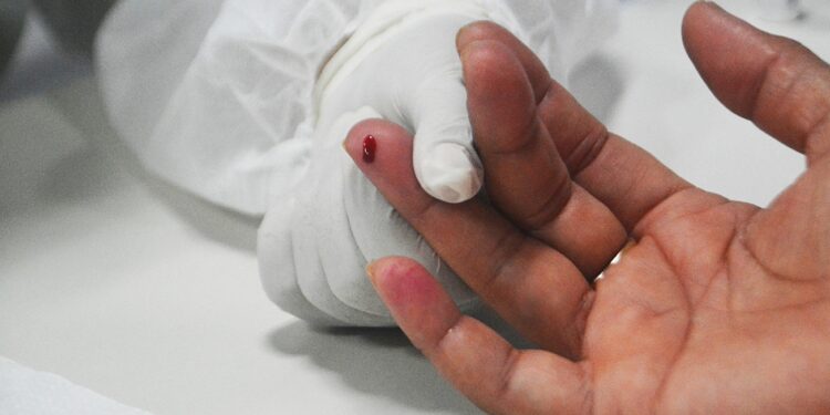 Julho Amarelo: em Feira 1.588 pacientes são acompanhados no programa municipal