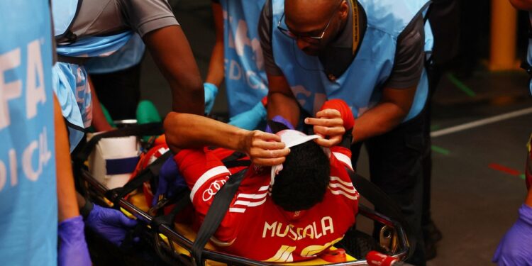 PSG x Bayern: Musiala sofre grave lesão no fim do primeiro tempo; a imagem é forte