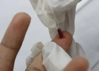 Bahia registra aumento de HIV no público entre 10 e 19 anos e gera alerta