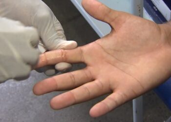 Casos de HIV/Aids aumentam mais de 10% em Feira de Santana; especialistas alertam para riscos e indicam tratamento precoce