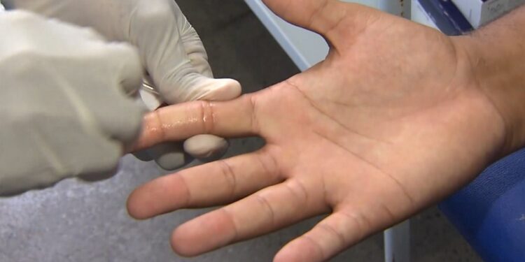 Casos de HIV/Aids aumentam mais de 10% em Feira de Santana; especialistas alertam para riscos e indicam tratamento precoce