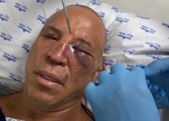 Wanderlei Silva é levado ao hospital após confusão generalizada