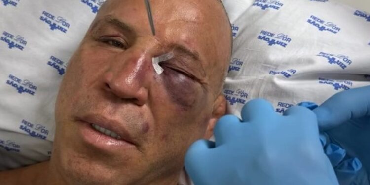 Wanderlei Silva é levado ao hospital após confusão generalizada