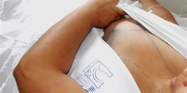 Fundação Hospitalar divulga resultado da primeira etapa do Programa de Tratamento de Gigantomastias