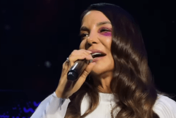 Ivete Sangalo passa por cirurgia no rosto, após queda e desmaio