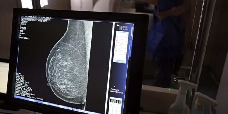 Carreta oferece mamografias gratuitas em Feira de Santana, Jequié e Alagoinhas; saiba como agendar