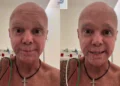 Cantor Netinho é internado após volta do câncer; saiba estado de saúde