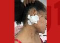 Mulher relata ter sido arrastada por carro de ex-companheiro após briga em Feira de Santana