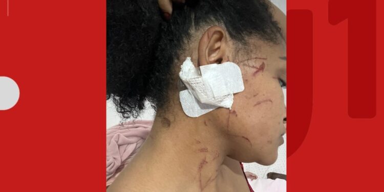 Mulher relata ter sido arrastada por carro de ex-companheiro após briga em Feira de Santana